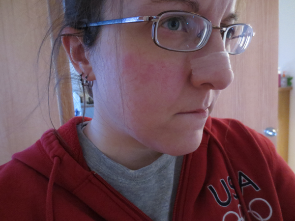 Sub zero cold? Or allergic reaction? Sub zero cold? Or allergic reaction?
